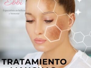 Curso tratamiento de manchas